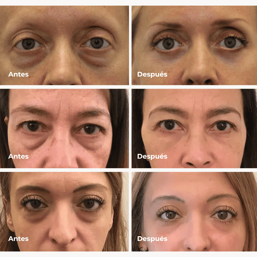 Parche de Colágeno Puro – Rejuvenecimiento Facial en Minutos