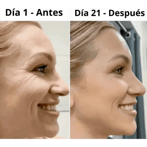 LumiLift Pro™ – Masajeador Facial Anti edad -  Regalo perfecto para navidad