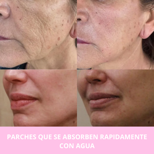 Parche de Colágeno Puro – Rejuvenecimiento Facial en Minutos