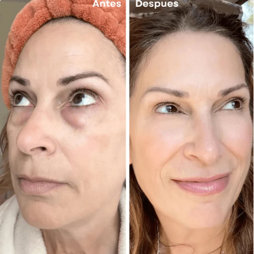 Parche de Colágeno Puro – Rejuvenecimiento Facial en Minutos